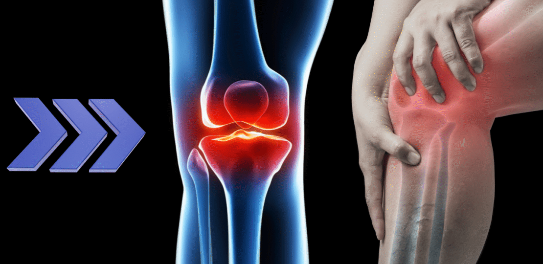 dor no joelho o que fazer (1)